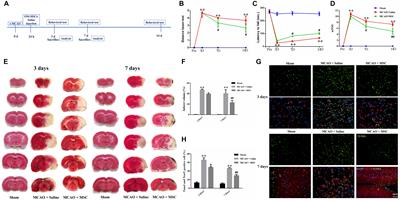 Olfactory Mucosa Mesenchymal Stem Cells Ameliorate Cerebral Ischemic/Reperfusion Injury Through Modulation of UBIAD1 Expression